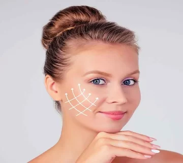 نخ کلاژن برای خط خنده