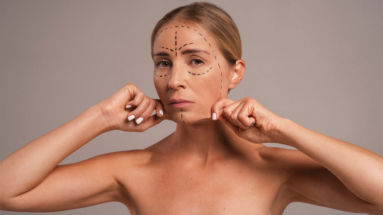لیفت شقیقه با نخ